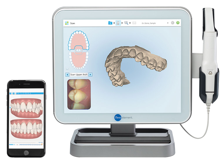 Invisalign iTero tratamiento en ortodoncia invisible y simulación en smartphone