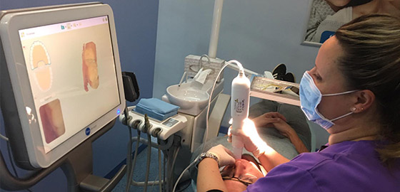 Primera vista escàner iTero en la clínica dental Orthodontic Tarragona
