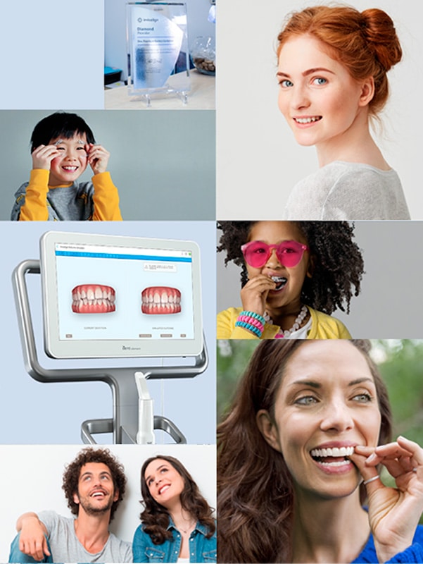 Invisalign y escaner iTero para ortodoncia invisible primera visita