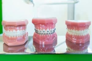 Foto portada movil 20 preguntas de ortodoncia para el día mundial de la ortodoncia
