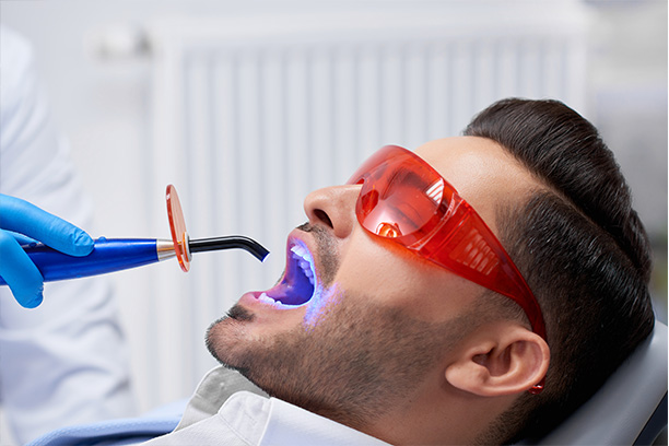 Un blanqueamiento dental en la clínica dental